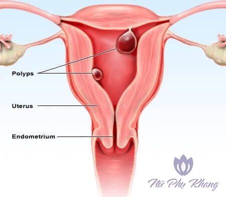 Điểm danh 4 căn bệnh thường gặp ở cổ tử cung