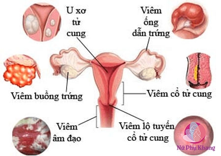 rong-kinh-do-dat-vong-tranh-thai